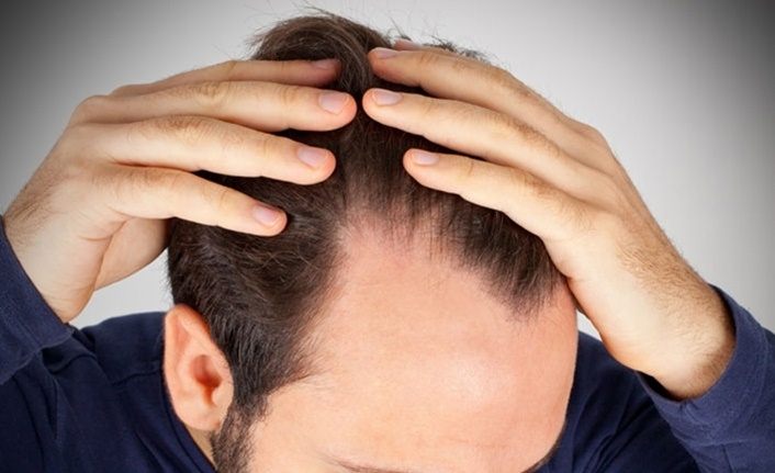Koronavirüs cilt hastalıkları ve saç dökülmesine neden oluyor