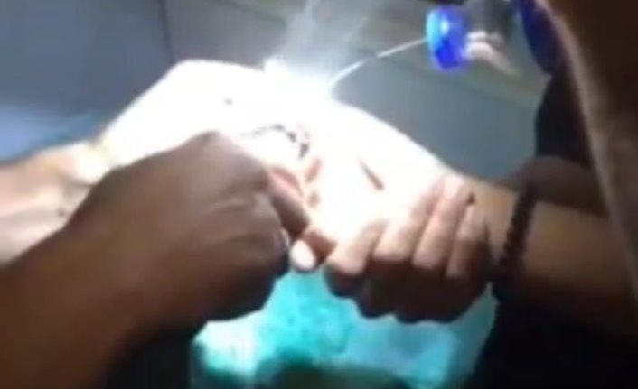 Van'da 14 yaşındaki çocuğun parmağına sıkışan yüzük çıkarıldı