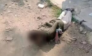 Pakistan’ın başkenti İslamabad’ın G-6 bölgesinde sokak ortasında elleri ve ayakları