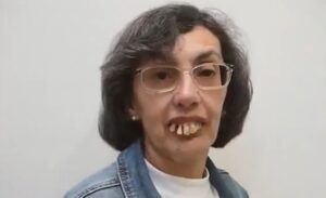 Yabancı bir doktor, 59 yıl boyunca dişleri yüzünden zorluklar çeken