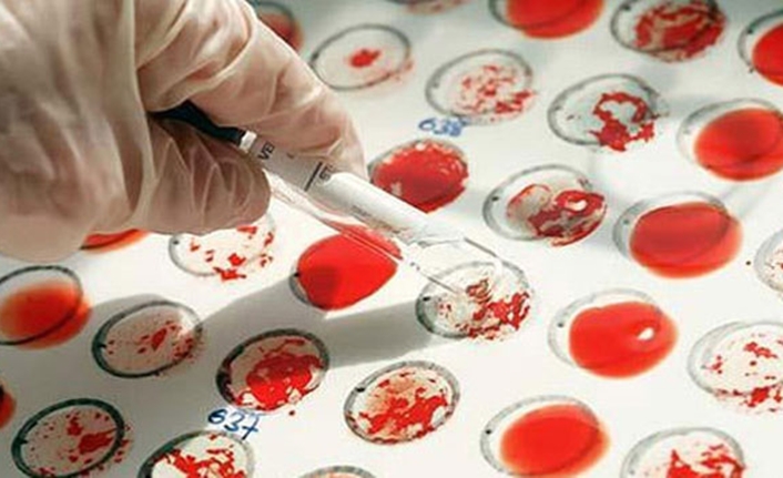 İngiltere’de 50 yıldır çalışmalarını sürdüren bilim insanları, yeni bir kan grubunu keşfetti.