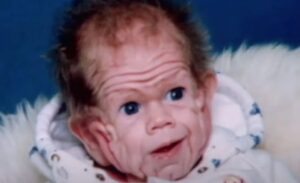 Avustralya’da yaşayan Tomm Tennent isimli şahıs, dünyaya gelişiyle birlikte tıp