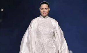 Ünlü model Adriana Lima, yüzündeki değişim ve kiloları nedeniyle sık