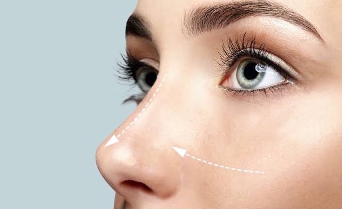 Son yıllarda giderek artan burun estetiği talepleri uzmanları harekete geçirdi.