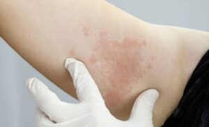 Sıcaklıkların artmasıyla birlikte kalın ve sentetik kıyafetler giymeye devam edenlere